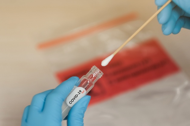 Coronavirus, 190 nuovi casi. Un decesso